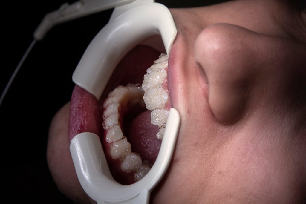 Photo teeth falling out